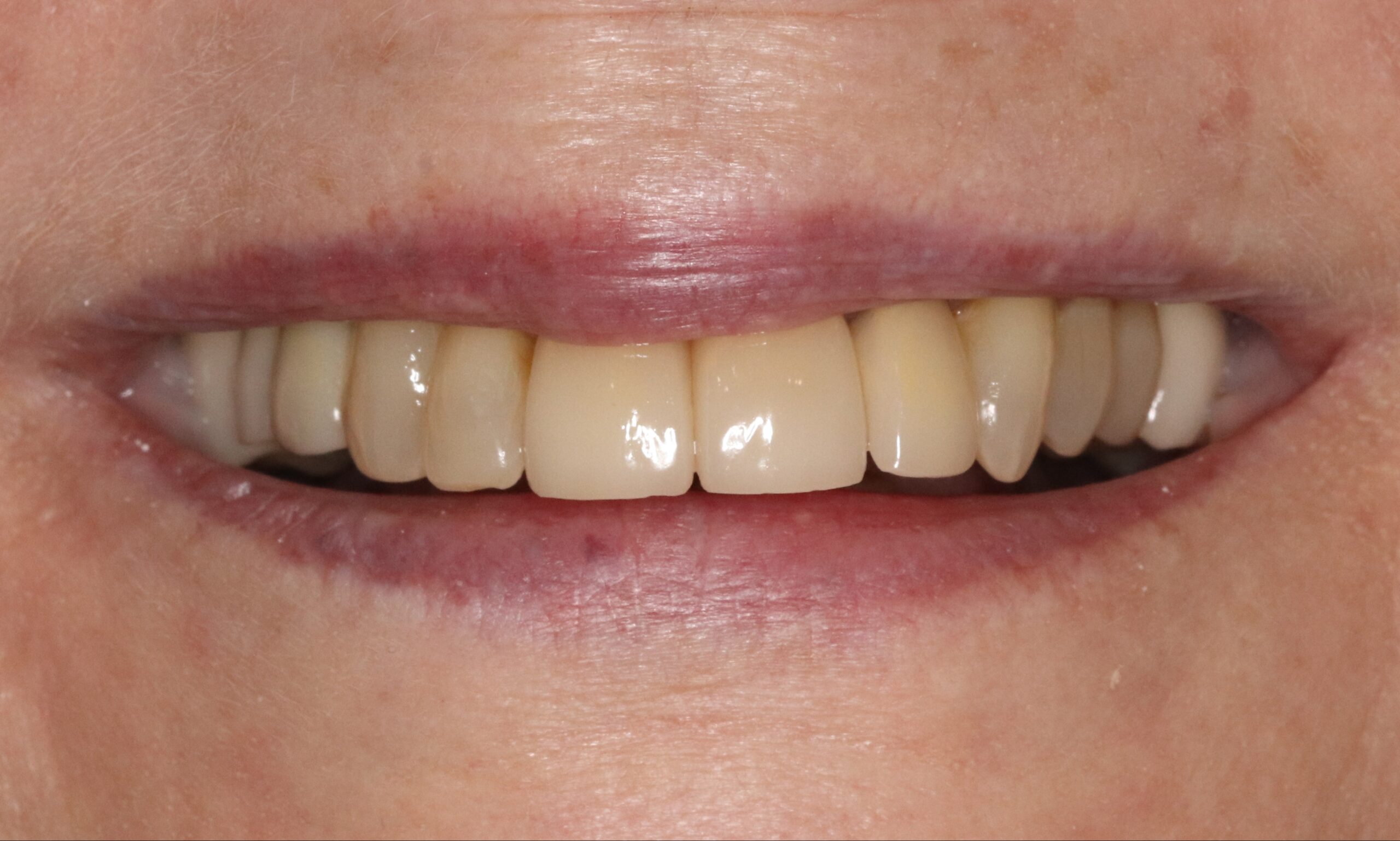 Case1 Cosmetic After
