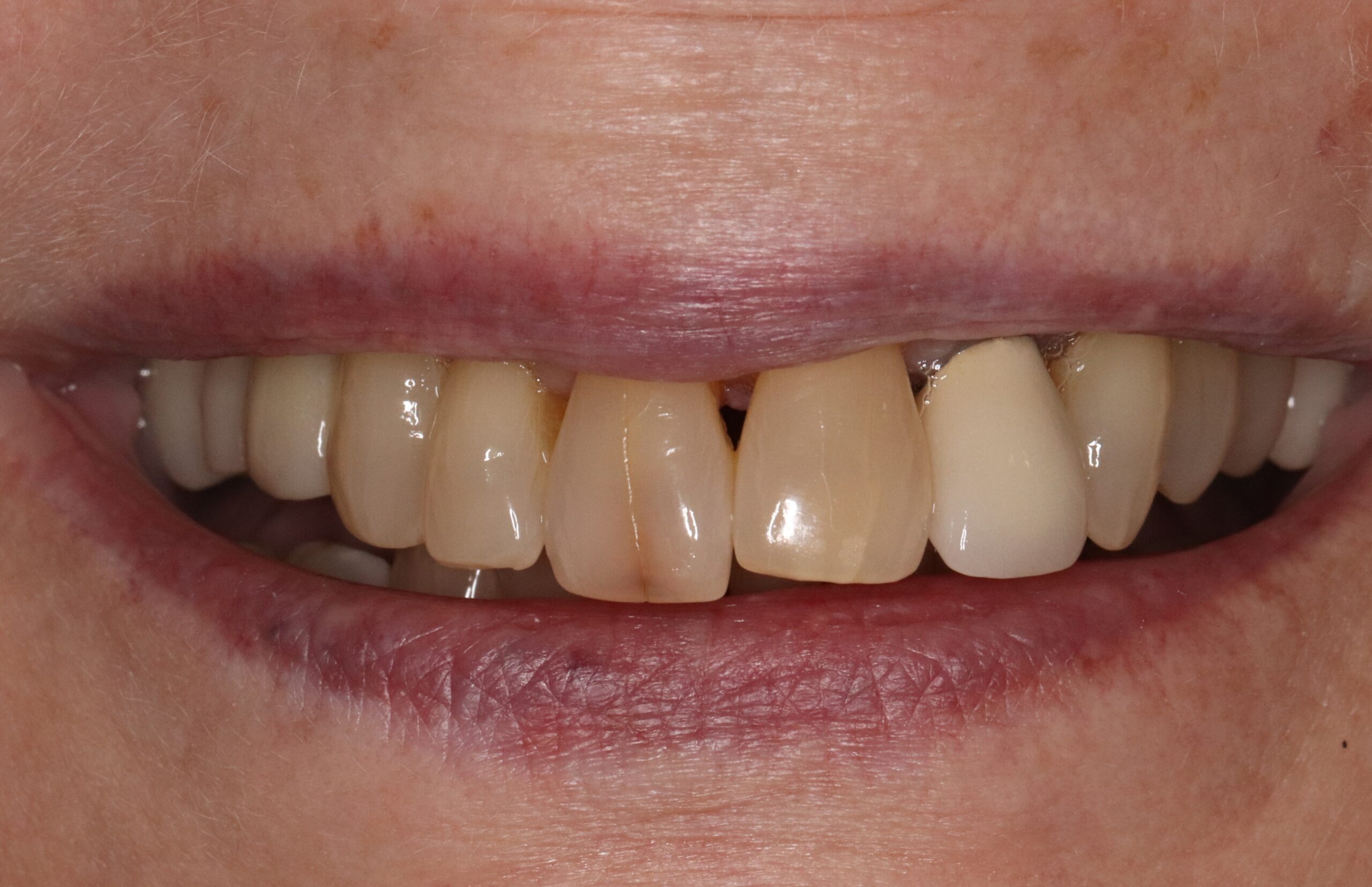 Case1 Cosmetic Before