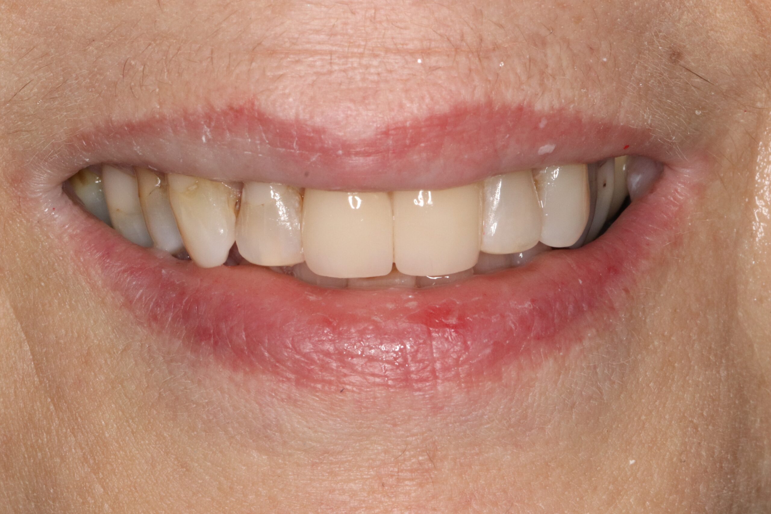 Case2 Cosmetic After