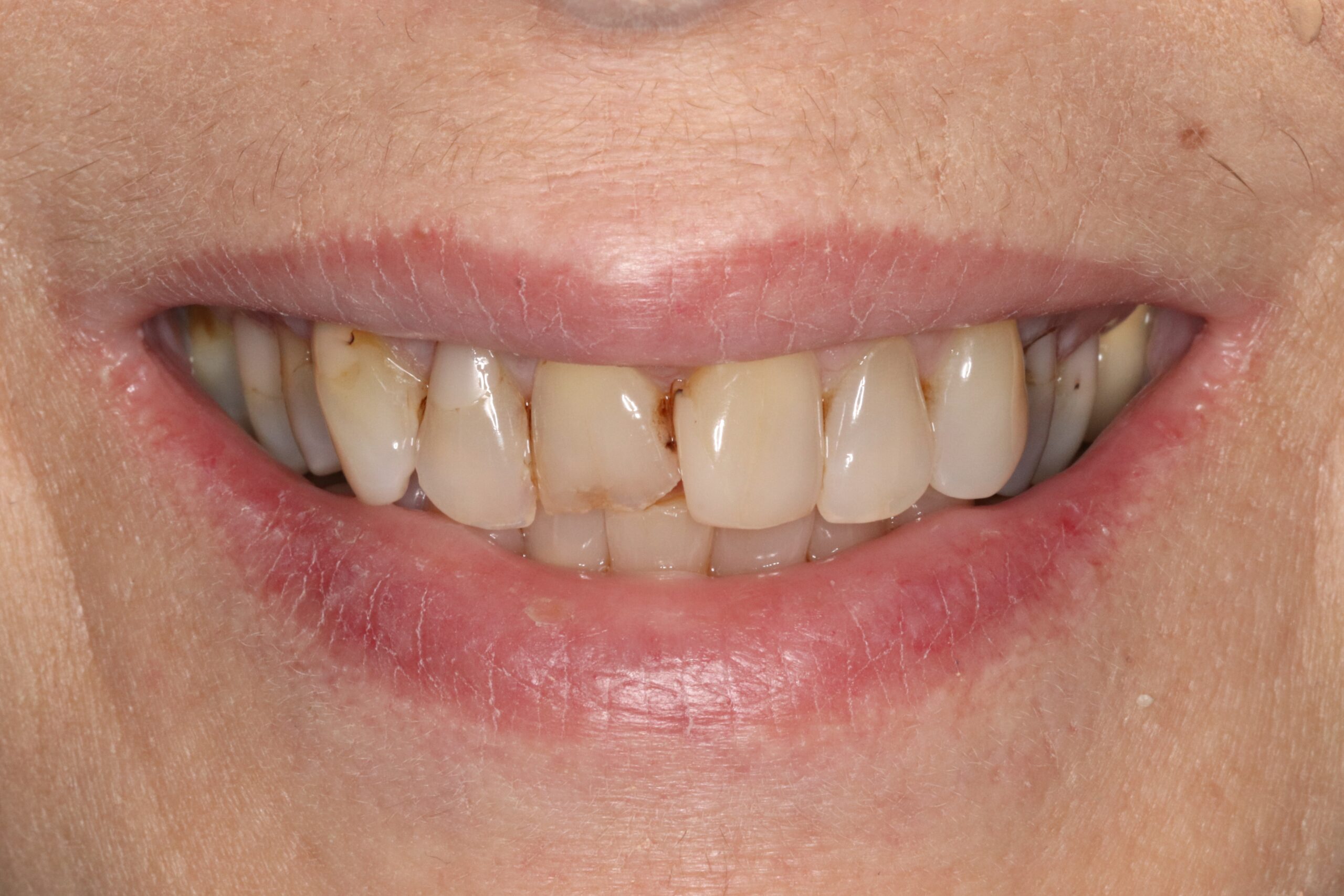 Case2 Cosmetic Before